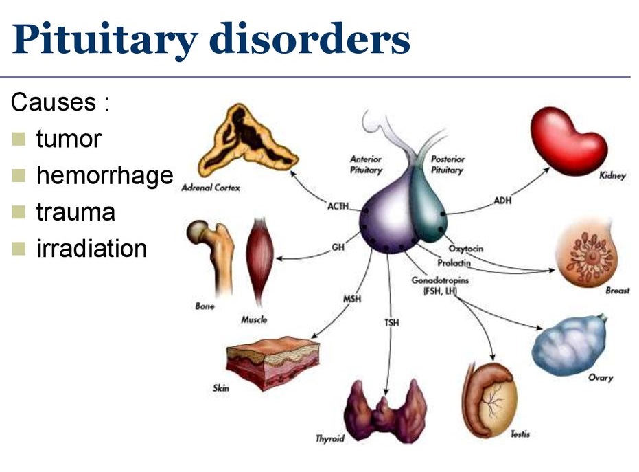 Pituitary Gland Disorders Treatment in Hyderabad | EndoRheuma Care